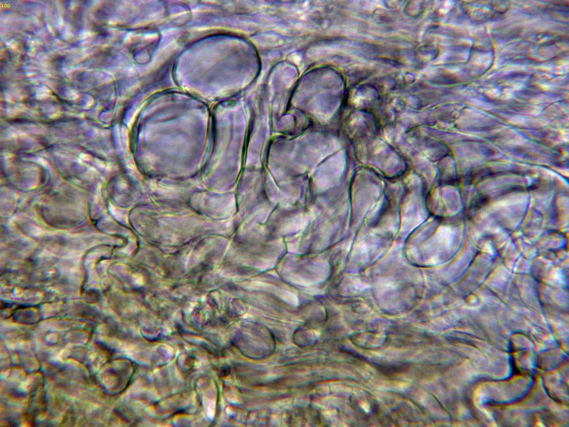 Microscopía de Russula violeipes - 10 - Subpellis agua-001